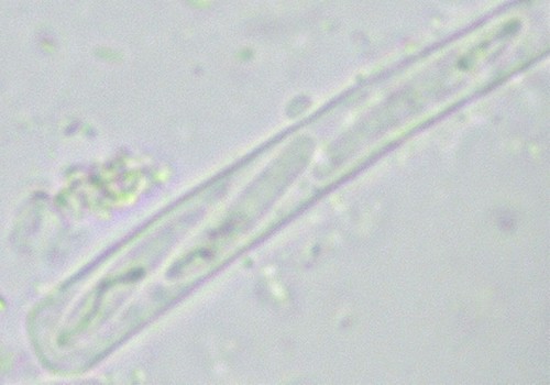 Orbilia rosea - 