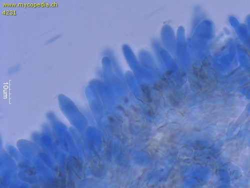 Baeospora myosura - Cheilozystiden - Patentblau  - 