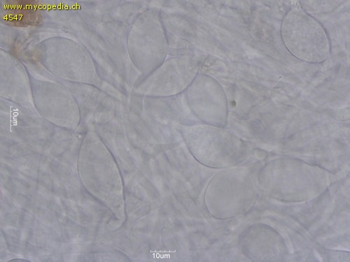 Singerocybe phaeophthalma - HDS mit blasigen Zellen - 