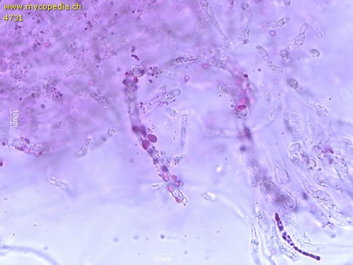 Russula velutipes - Primoridalhyphen inkrustiert - 