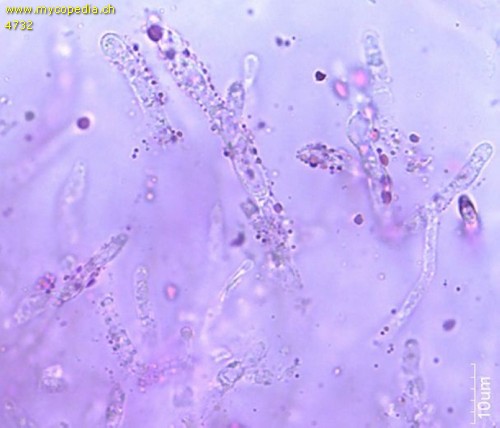 Russula velutipes - Primoridalhyphen inkrustiert - 