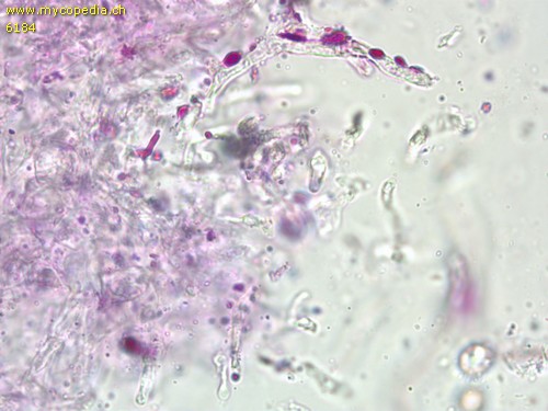 Russula emeticicolor - Primoridalhyphen inkrustiert - 