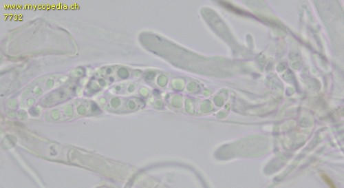 Sclerotinia echinophila - Asci - KOH  - 