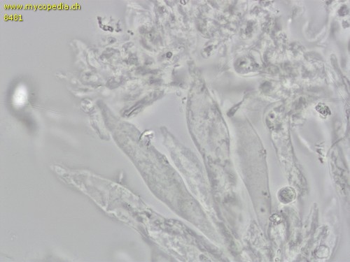 Leucoagaricus leucothites - Cheilozystiden - 
