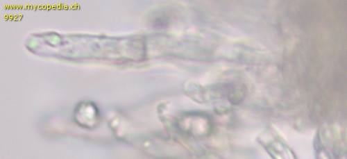 Fibrodontia fimbriata - Hyphen - 