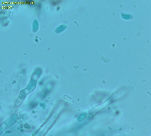 Athelopsis lacerata - Sporen - 