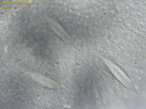 Hohenbuehelia petaloides - Cheilozystiden - 