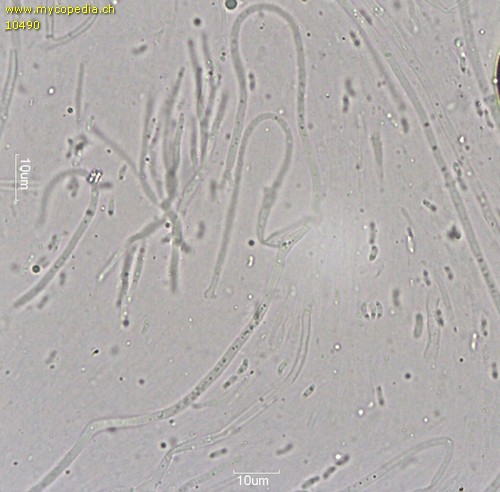 Ascocoryne albida - Konidiosporen - 