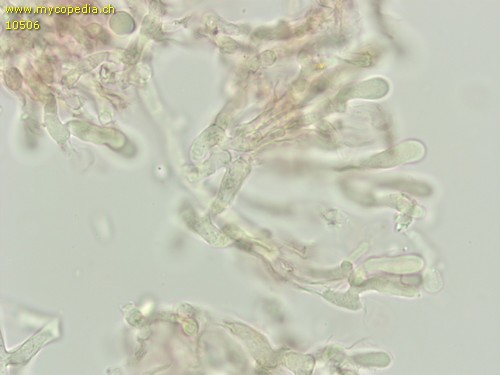 Leptosporomyces septentrionalis - 