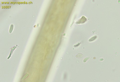 Leptosporomyces septentrionalis - Sporen - 