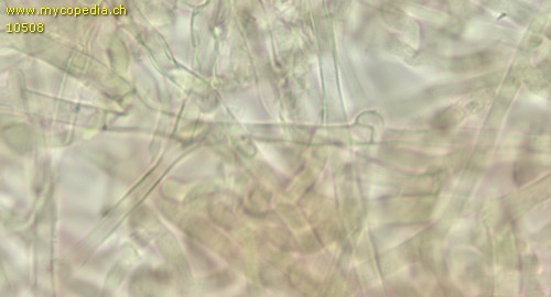 Leptosporomyces septentrionalis - Hyphen mit Schnallen - 