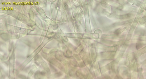 Leptosporomyces septentrionalis - Hyphen mit Schnallen - 