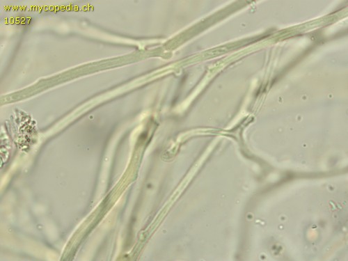 Dacrymyces variisporus - Hyphen mit Schnallen - 