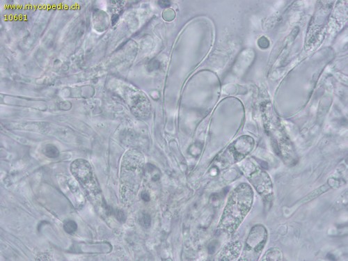 Clitocybula platyphylla - Cheilozystiden - 