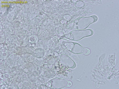 Coprinopsis marcescibilis - Cheilozystiden - 