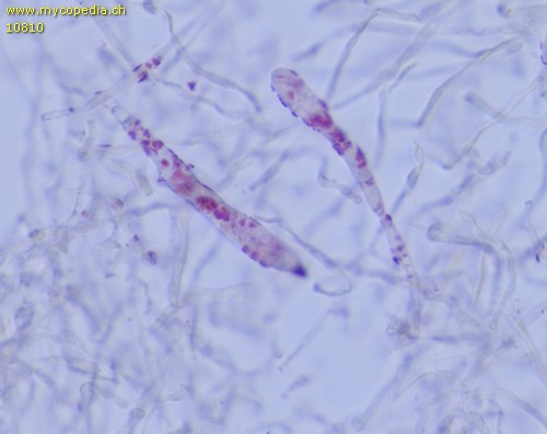 Russula amethystina - Primoridalhyphen inkrustiert - 