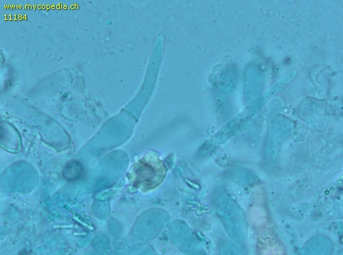 Melanoleuca grammopodia - Cheilozystiden - 