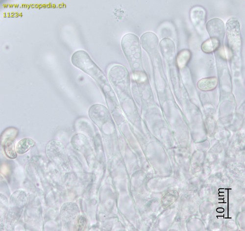 Tubaria furfuracea - Cheilozystiden - 