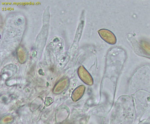 Pholiotina pygmaeoaffinis - Cheilozystiden - 