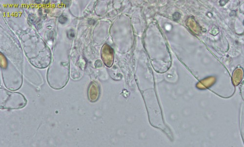 Pholiotina pygmaeoaffinis - Cheilozystiden - 