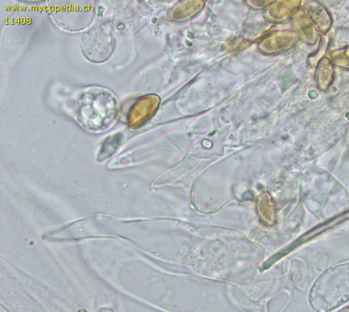 Pholiotina pygmaeoaffinis - Cheilozystiden - 