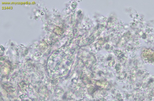 Exidiopsis effusa - Phragmobasidien - 