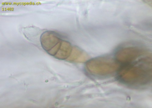 Lophiostoma compressum - Ostiolum - 