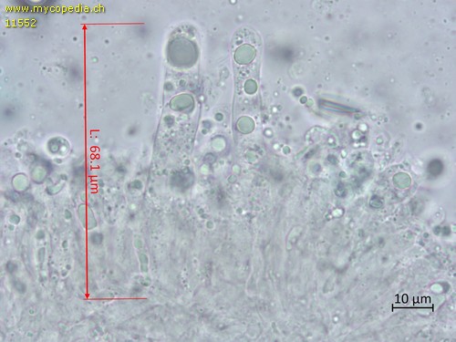 Dermoloma pseudocuneifolium - Cheilozystiden - Patentblau  - 