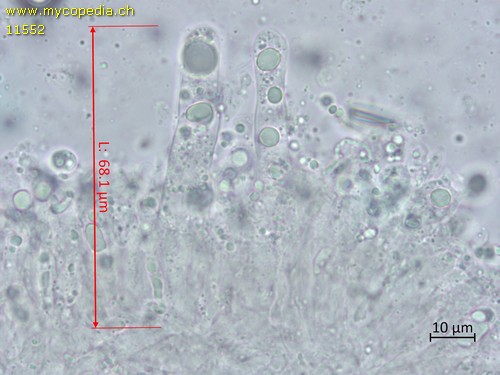 Dermoloma pseudocuneifolium - Cheilozystiden - Patentblau  - 