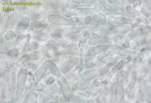 Mucronella flava - Zystiden - 