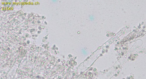 Dermoloma pseudocuneifolium - Cheilozystiden - Wasser  - 