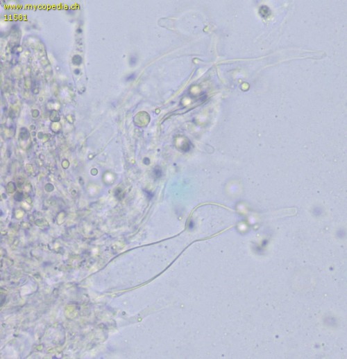 Vesiculomyces citrinus - Gloeozystiden - 
