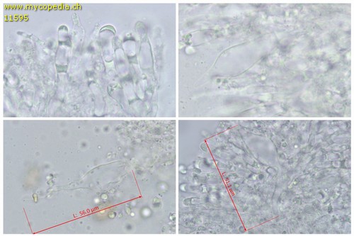 Vesiculomyces citrinus - Gloeozystiden - Wasser  - 