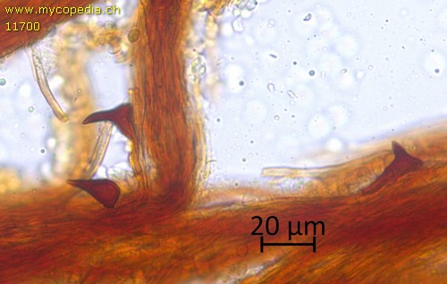 Mensularia radiata - Setae - KOH  - 