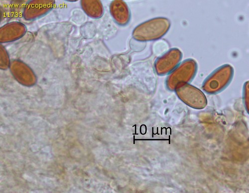 Conocybe tenera - Cheilozystiden - KOH  - 