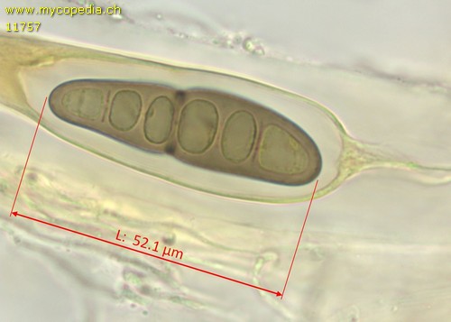 Splanchnonema argus - Sporen - Melzers  - 