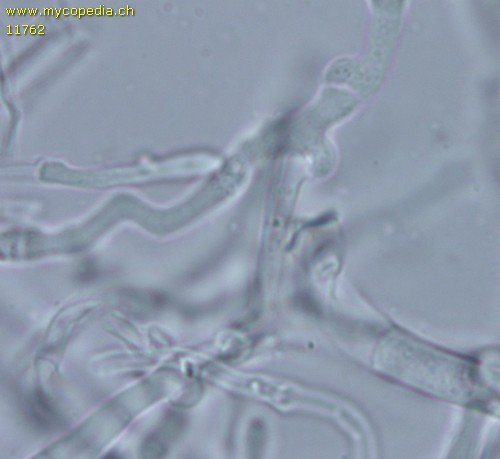 Phlebia radiata - Hyphen mit Schnallen - KOH  - 