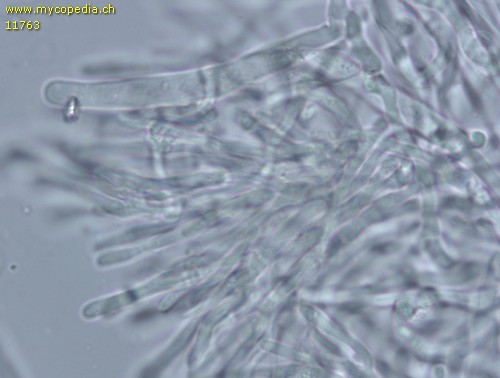 Phlebia radiata - Lepotozystide - 