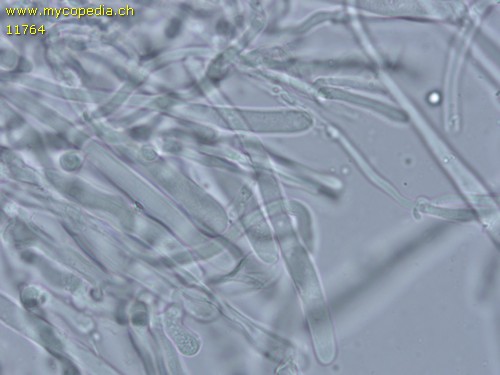 Phlebia radiata - Leptozystiden - 