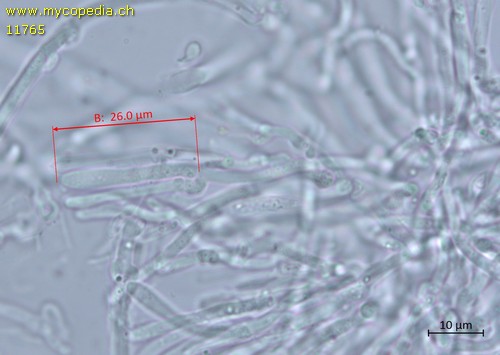 Phlebia radiata - Basidien - 