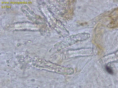 Steccherinum fimbriatum - Skeletozystiden inkrustiert - 