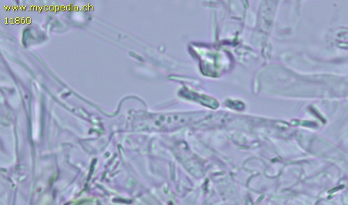 Leptosporomyces mutabilis - Hyphen mit Schnallen - 