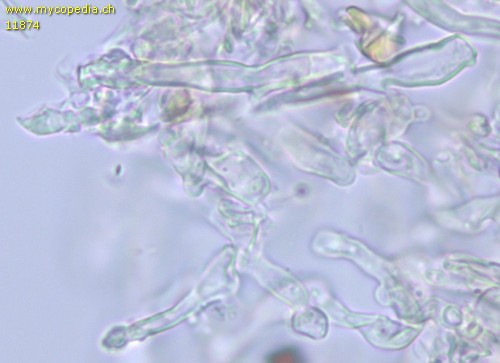 Hyphodontia alutaria - Lagenozystiden - 