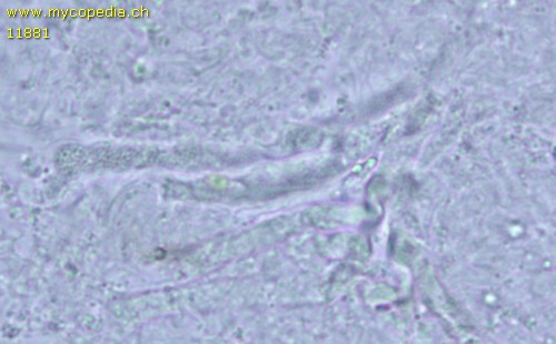 Sistotrema coroniferum - Gloeozystiden - 