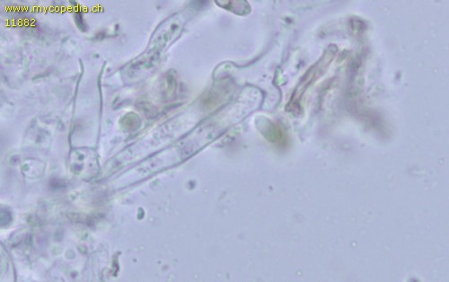 Sistotrema coroniferum - Hyphen mit Schnallen - 