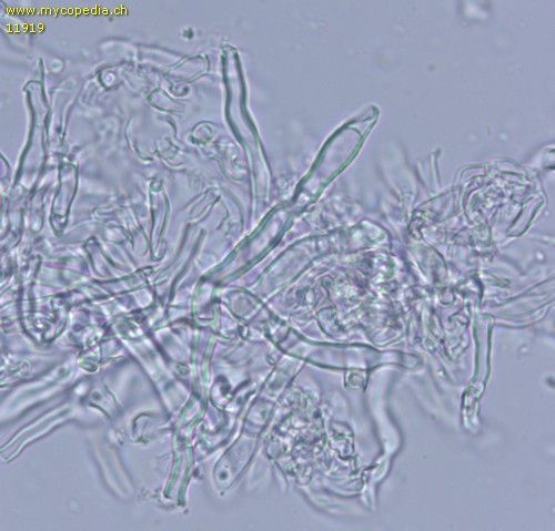 Hyphodontia microspora - Leptozystiden - 