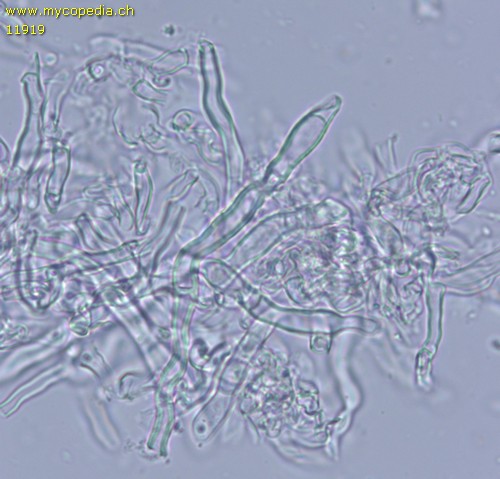 Hyphodontia microspora - Leptozystiden - 