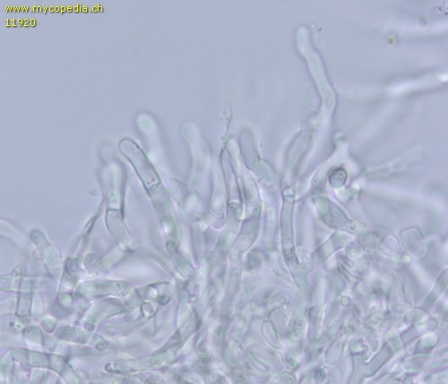 Hyphodontia microspora - Leptozystiden - 