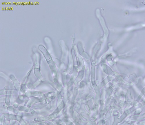 Hyphodontia microspora - Leptozystiden - 