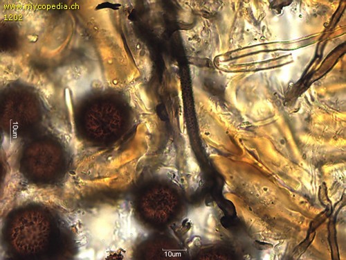 Elaphomyces granulatus - Skeletthyphen - 